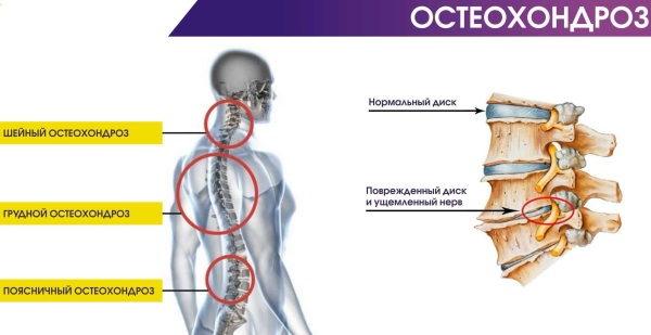 Нифедипин при беременности. Инструкция по применению, аналоги, отзывы