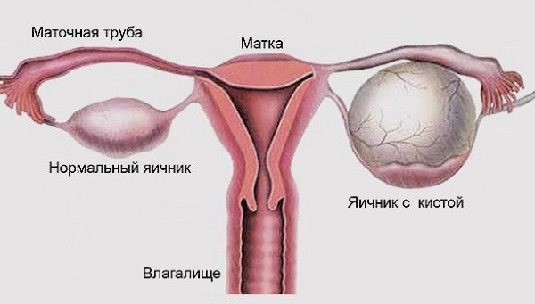 Норма цикла месячных у женщин, подростков. Сколько дней длится, как считать