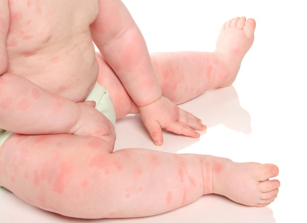 Нутрилон (Nutrilon) Пепти Гастро. Отзывы, инструкция по применению, состав, цена