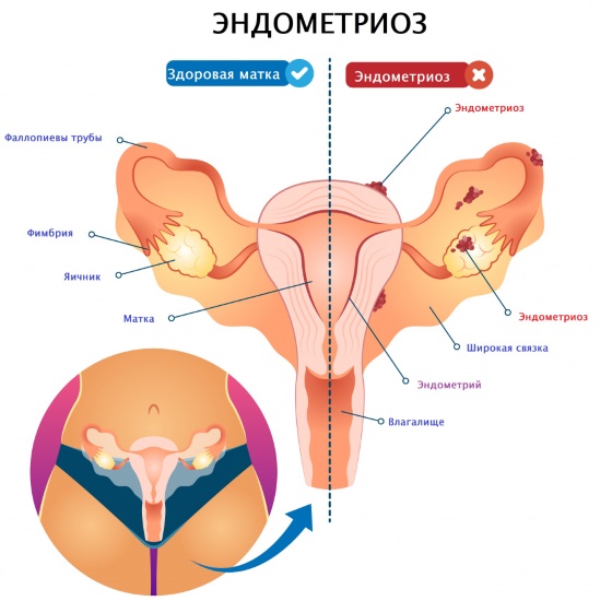 Самые опасные недели беременности во всех триместрах
