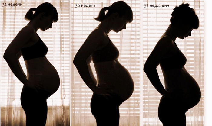 Опущение живота перед родами у первородящих. Как определить