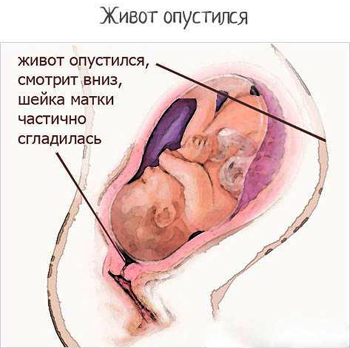 Опущение живота перед родами у первородящих. Как определить