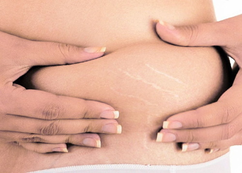 Опустился живот при беременности. Когда рожать у повторнородящих, первородящих, как определить, ощущения