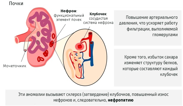Отеки при беременности на ранних, поздних сроках. Как избавиться, лечить в 1, 2, 3 триместре народными средствами и лекарствами