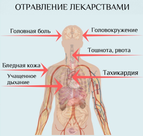 Отравление при беременности 1-2-3 триместр. Что делать