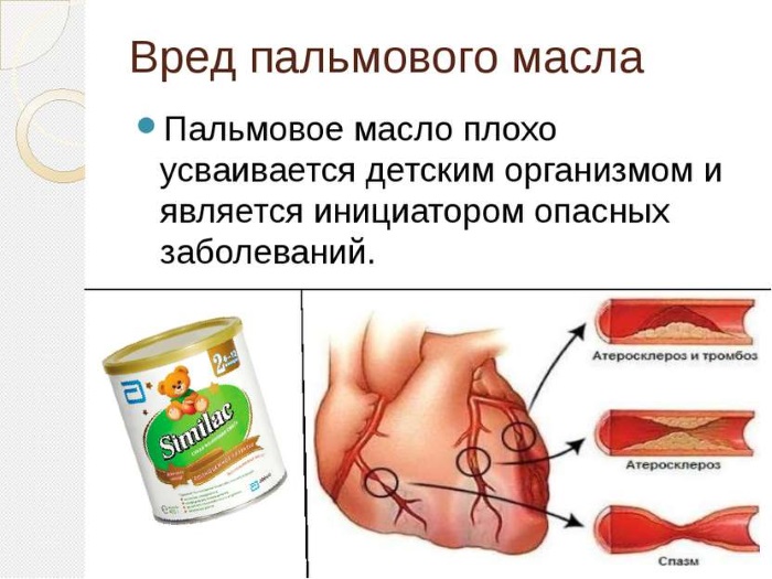 Пальмовое масло. Польза и вред в детском питании, из чего делают, виды, опасно ли, список смесей для новорожденных без масла. Мнения врачей