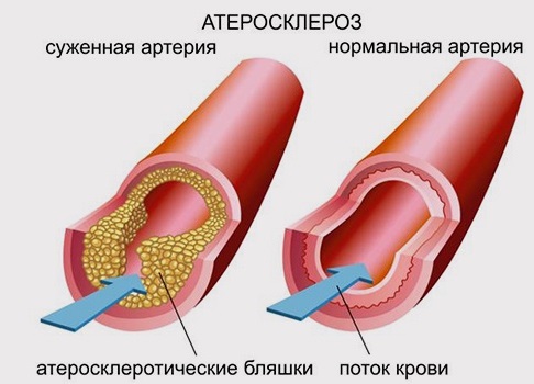 Пальмовое масло. Польза и вред в детском питании, из чего делают, виды, опасно ли, список смесей для новорожденных без масла. Мнения врачей