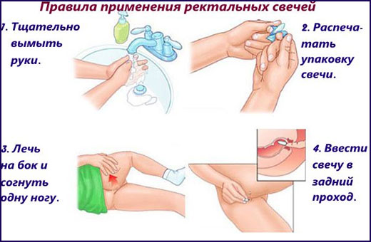 Папаверин свечи при беременности для чего назначают. Инструкция