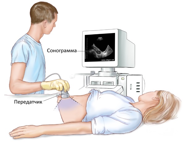 Первый скрининг при беременности. Как делают, сроки, что показывает, как подготовиться, нормы расшифровка УЗИ, опыт женщин на форумах