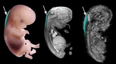Первый скрининг при беременности. Как делают, сроки, что показывает, как подготовиться, нормы расшифровка УЗИ, опыт женщин на форумах