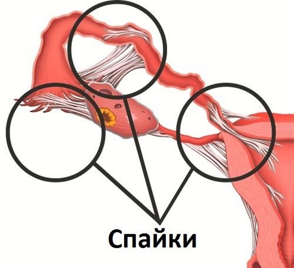 Плановое кесарево сечение. На каком сроке делают, подготовка, как происходит, отзывы