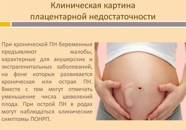 Плацентарная недостаточность при беременности. Что это такое, причины, лечение, последствия, симптомы