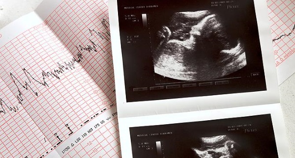 Плацентарная недостаточность при беременности. Что это такое, причины, лечение, последствия, симптомы