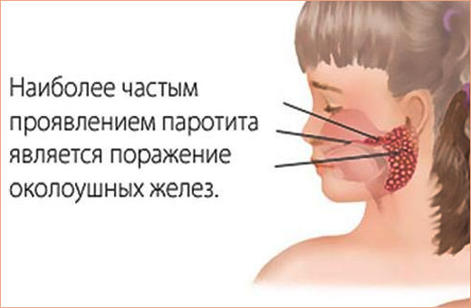 Покраснение вокруг рта у ребенка. Фото, причины и лечение, рацион питания