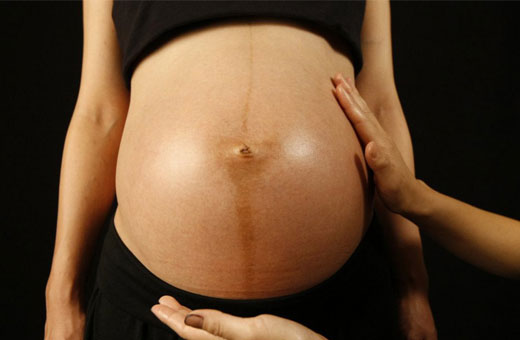 Полоса на животе у беременных. Что это, когда появляется, почему, когда пройдёт