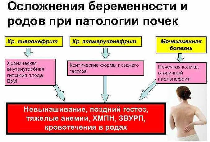 Поздняя беременность после 40 лет. Мнение, риски