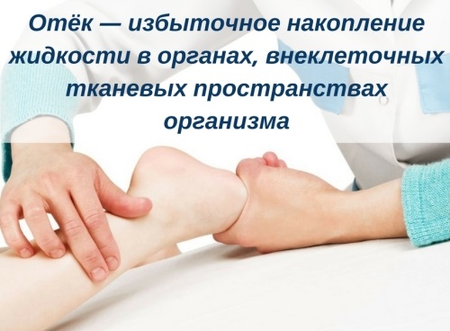 Продукты, выводящие жидкость из организма, при беременности, для похудения. Какие задерживают жидкость