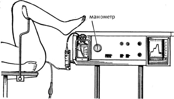 Продувание маточных труб. Как называется процедура, как делают, отзывы