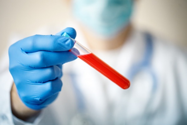 Протромбиновый индекс (ПТИ) по Квику. Что это такое у женщин, норма