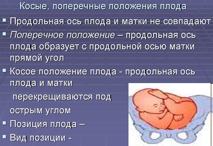 Расположение ребенка в животе по неделям беременности