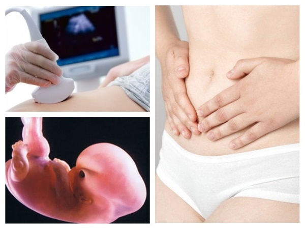 Размер плодного яйца по неделям беременности. Таблица от зачатия