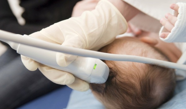 Родничок у новорожденных: когда зарастает - нормы. Где находится, как выглядит, форма. Что означает маленький, большой, если пульсирует