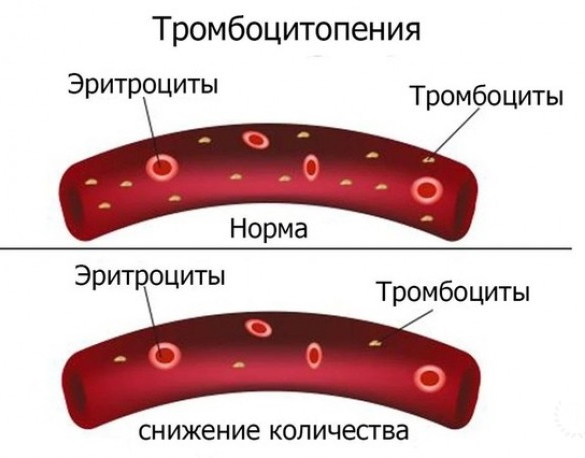 Розовая моча у ребенка 2-3-4-5 лет. Причины