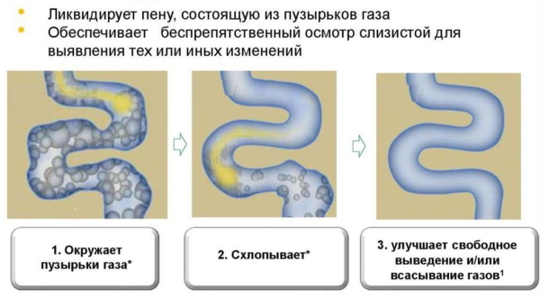 Саб Симплекс для новорожденных. Инструкция, как давать, сколько, отзывы