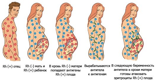 Semper (Семпер) питание детское для новорожденных. Ассортимент, виды смеси, состав, цена