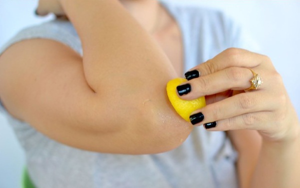 Шелушатся локти. Причины у женщин, лечение организма при гв, беременности, слабом иммунитете. Питание, витамины, уход за кожей