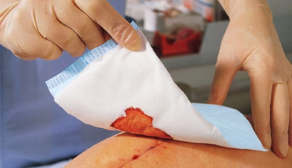 Шов после кесарева сечения: уход, сколько заживает уплотнение, что делать, если болит, разошелся, сочится, мокнет, загноился, покраснел