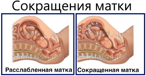 Схватки перед родами. Интервал, как распознать, когда ехать в роддом, периодичность, ощущения