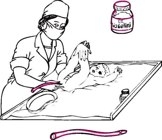 Колики у новорожденного. Симптомы, как помочь ребенку, лечение