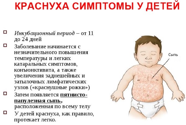 Симптомы краснухи у детей. Фото от начальной стадии до конечной, чем лечить