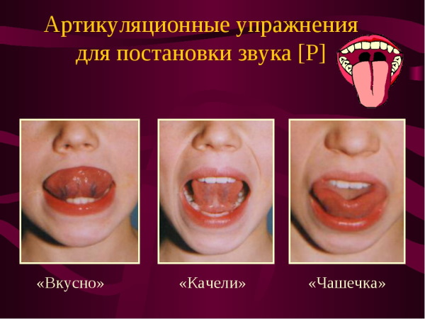 Скороговорки для хорошей дикции и речи детей. Логопедические упражнения, постановка звуков