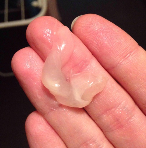 Слизистая пробка перед родами. Фото, как выглядит, за сколько отходит, размеры, какого цвета