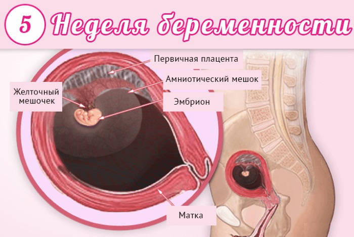 Слизистая пробка перед родами. Фото, как выглядит, за сколько отходит, размеры, какого цвета