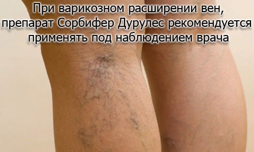 Сорбифер Дурулес. Инструкция по применению при беременности, до или после еды, побочные эффекты