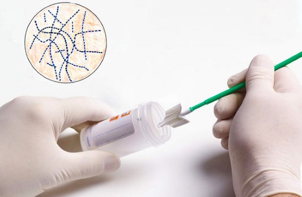 Стрептококк в мазке у женщин при беременности. Причины, симптомы, норма в анализе, лечение инфекции кожи