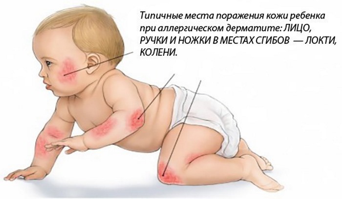 Как успокоить новорожденного ребенка, когда он плачет