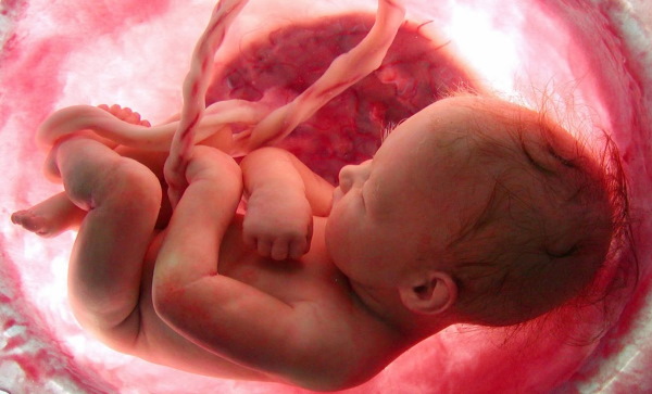 СЗРП при беременности. Что это такое в 30-38 недели, что делать