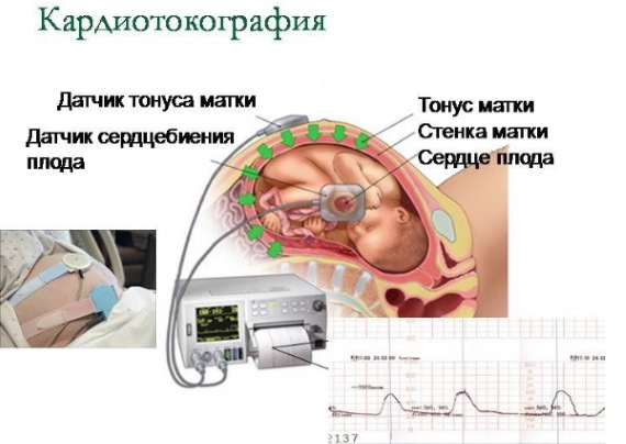 38 неделя беременности. Признаки приближающихся родов, что происходит с плодом, что чувствует женщина, развитие плода