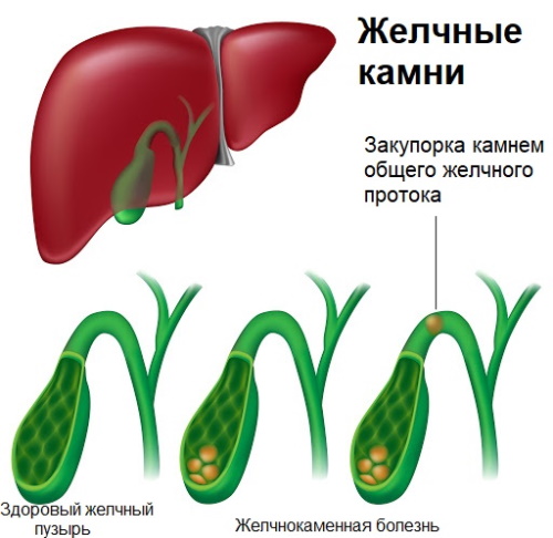 Темная моча у ребенка. Почему, причины в 2-3-4-5 лет