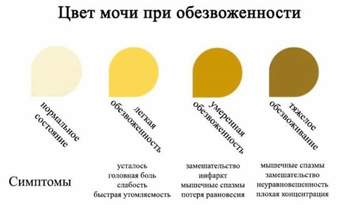 Темная моча у ребенка. Почему, причины в 2-3-4-5 лет