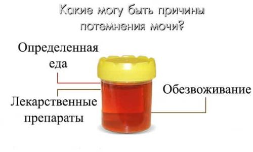 Темная моча у ребенка. Почему, причины в 2-3-4-5 лет