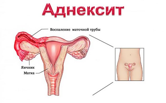Температура перед месячными может ли быть? За сколько дней поднимается