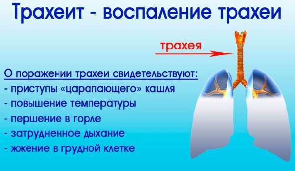 Трахеит у ребенка. Симптомы и лечение аллергический, острый. Антибиотики, народные средства, препараты