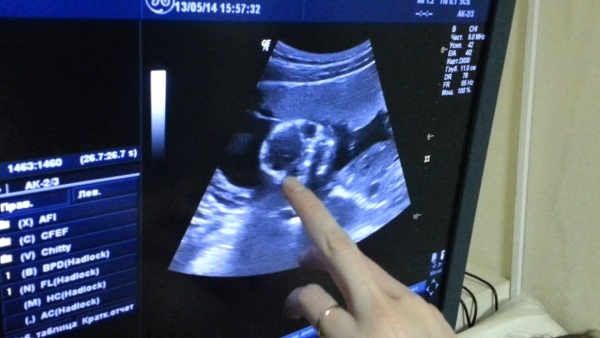 Триместры беременности по неделям и месяцам. Таблица развития плода, живота