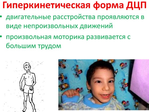 Триместры беременности по неделям и месяцам. Таблица развития плода, живота