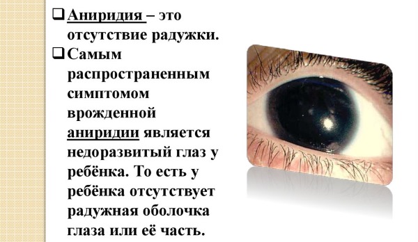 Цвет глаз у новорожденных. Когда меняется, формируется окончательно, возраст, какой бывает